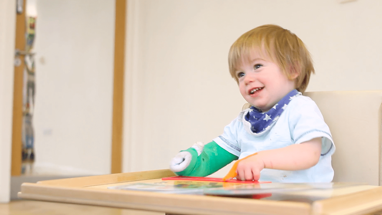 Alistair playing with his cast on.