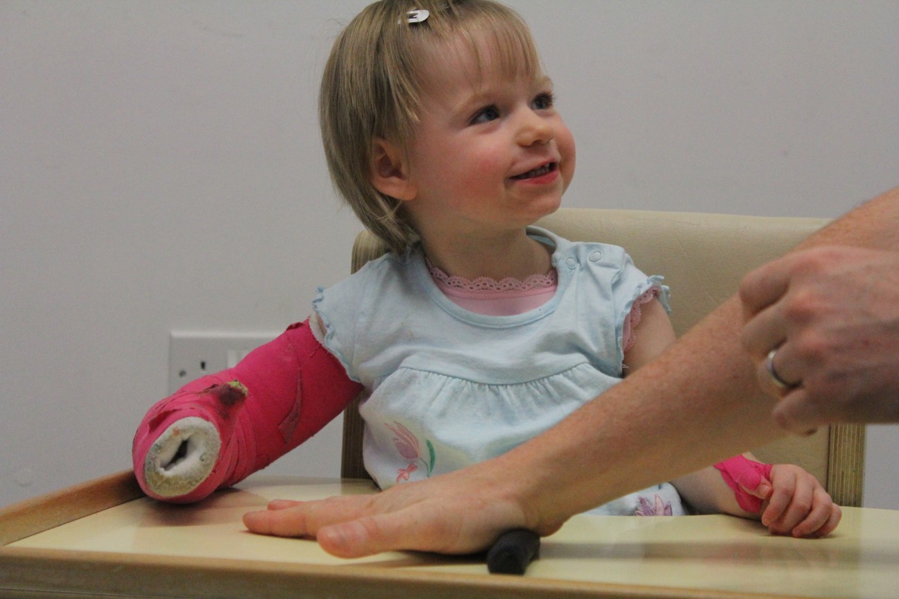 Leah excited about playing with CIMT therapists.